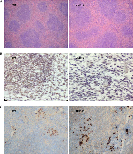 CXCR5 and PD-1 expression were tested by IHC.