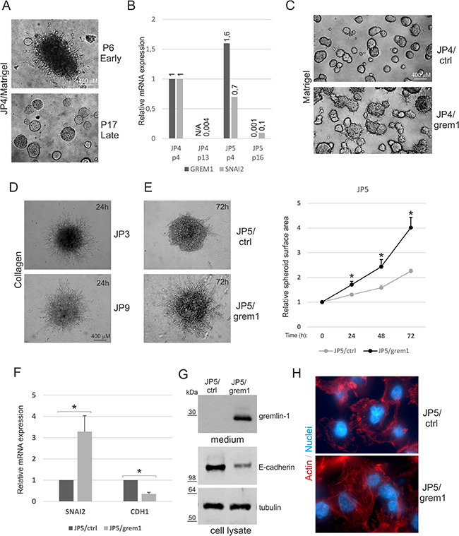Rescue of 3D invasive growth by gremlin-1 overexpression.