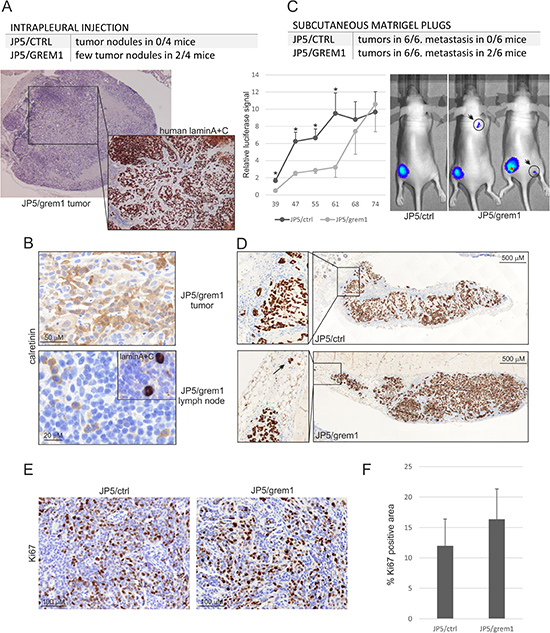 JP5/grem1 xenograft tumors show a tendency to send metastasis.
