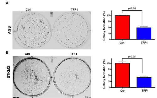 Reconstitution of TFF1 expression suppresses cell growth