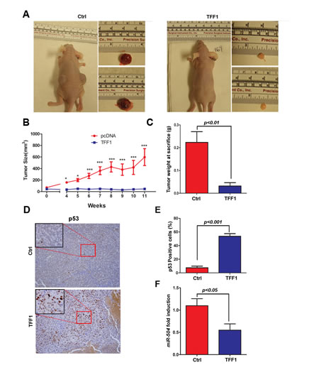 TFF1 suppresses tumor growth in a xenograft mouse model.