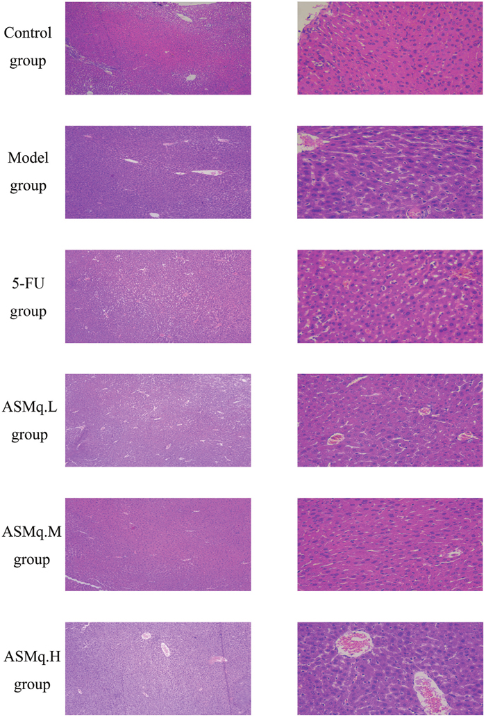 Liver pathology examination.