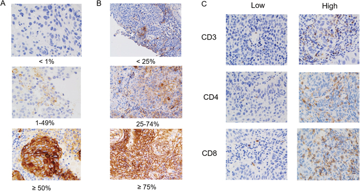 Immunohistochemical (IHC) staining patterns of PD-L1, HLA class I, CD3, CD4, and CD8 of patients with advanced hypopharyngeal squamous cell carcinoma.