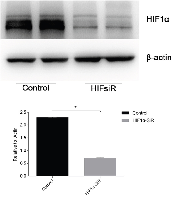 The knockdown efficiency of HIF1&#x03B1;-siRNA was evaluated.