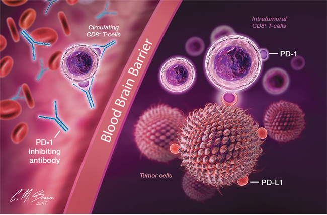 In recurrent disease, efficacy of nivolumab is limited by its inability to cross the blood brain barrier and a paucity of functional circulating T-cells with which to interact and form a protective barrier against subsequent possible PD-1/PD-L1 interactions.