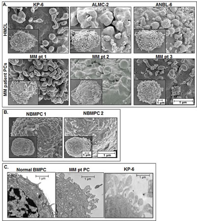 EM analysis of surface associated MVs.