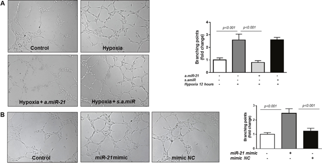 Matrigel tube formation assay in HREC.