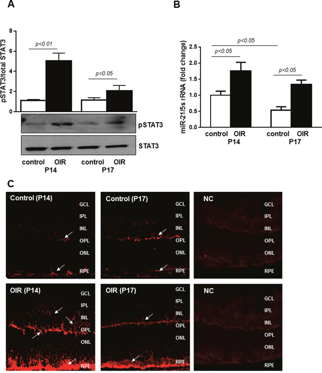 STAT3 and miR-21 are activated in retinas of OIR mice.