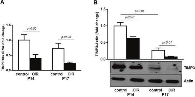 TIMP3 is downregulated in retinas of OIR mice.