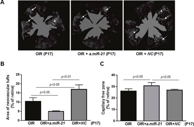 Intraorbital delivery of miR-21 inhibitor reduces pathological neovascularization in retinas of OIR mice.