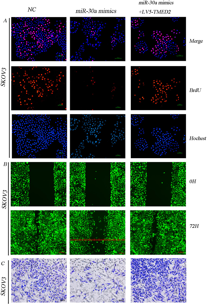 miR-30a regulated SKOV3 cellular proliferation, migration and invasion through directly targeting TMED2.