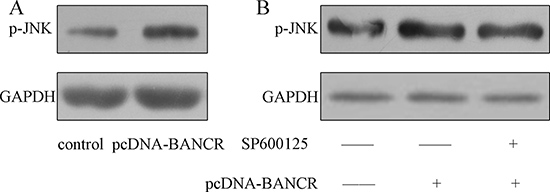 BANCR induced JNK signal pathway activation.