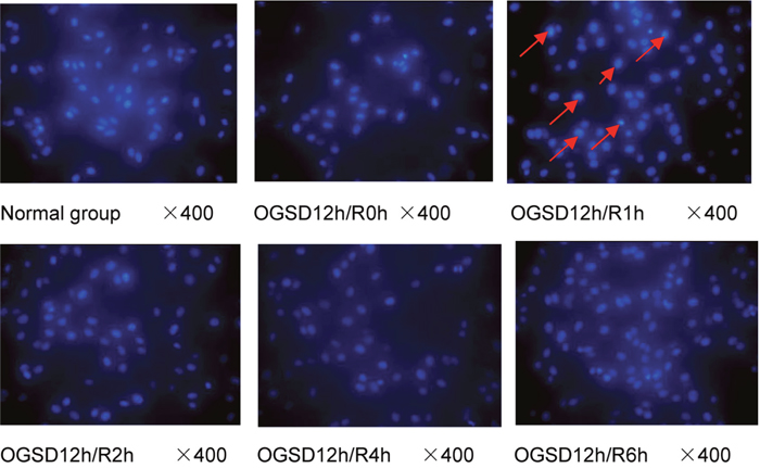 The apoptosis of a larger number of PC12, karyopyknosis, and partial nuclear fragmentation are found in group OGSD12h/R1h.