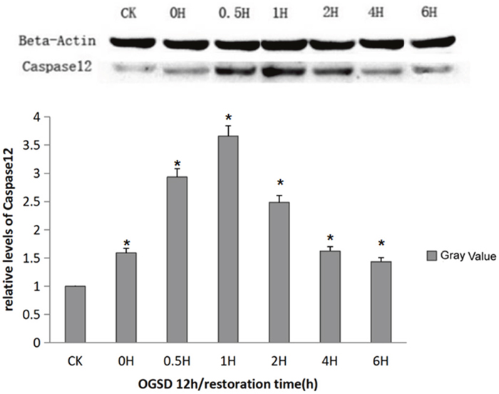 Caspase-12 protein expression at different time points.