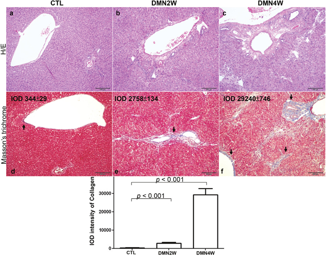 Upper panels: histologic examination of rat liver by H/E staining.