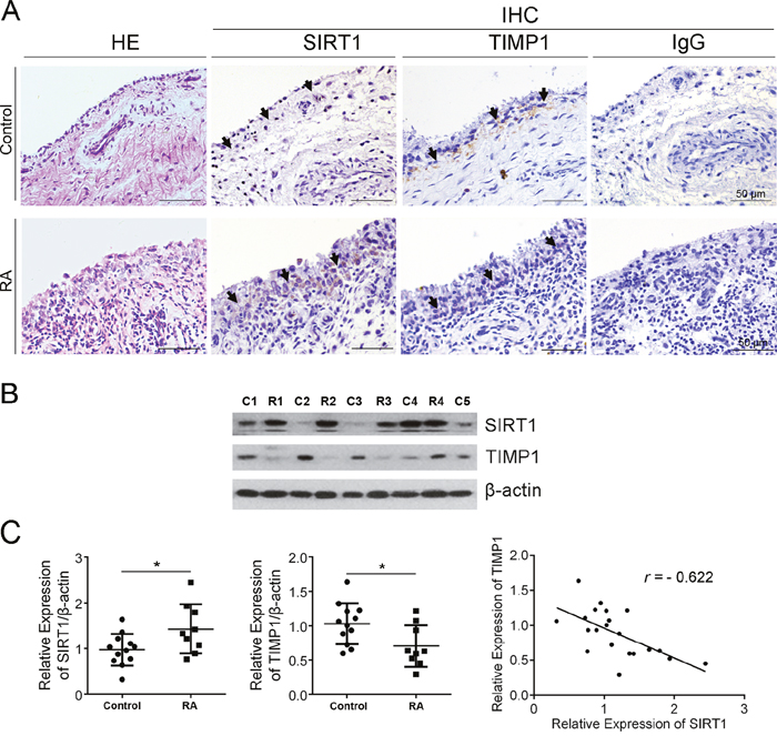 SIRT1 negatively correlated with TIMP1 in synovial tissue of RA patients.