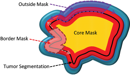 Cartoon image of the four tumor masks.