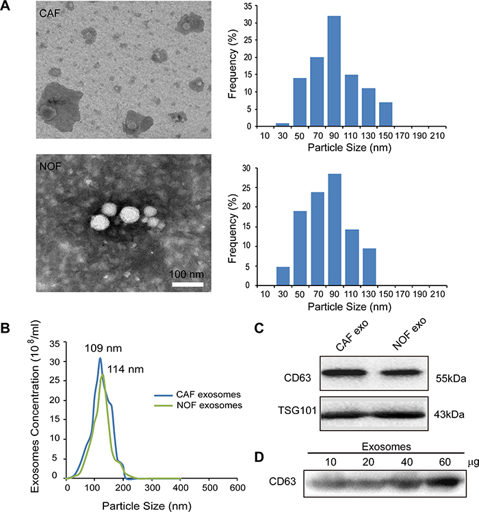 Characterization of exosomes derived from primary stromal fibroblasts.