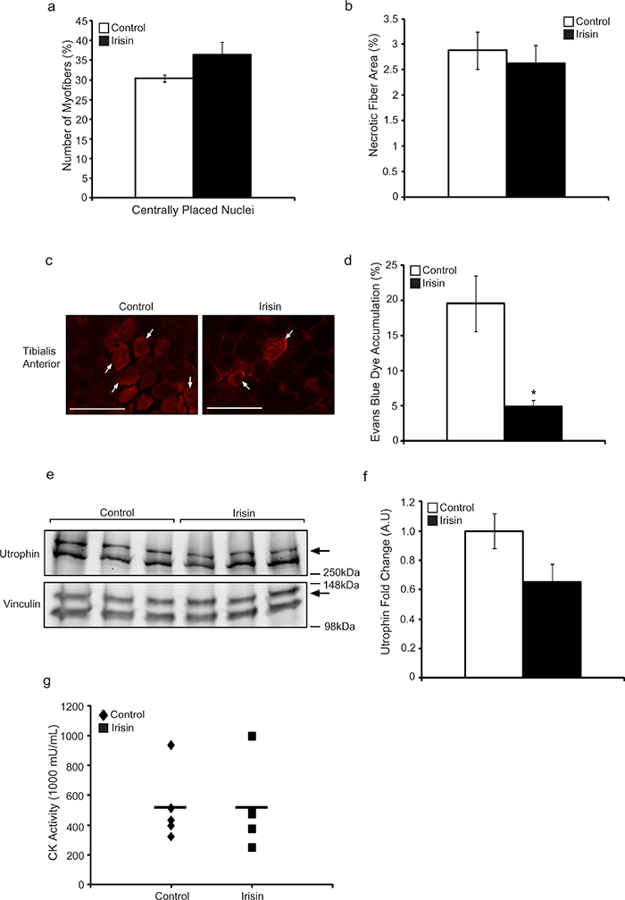 Irisin injection protects young mdx mice from dystrophic-associated skeletal muscle degeneration.