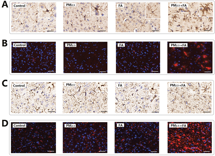 Representative images (&#x00D7;400) of the expression of Iba1 and GFAP as determined by immune-histochemical staining (brown color stain) and immunofluorescence.