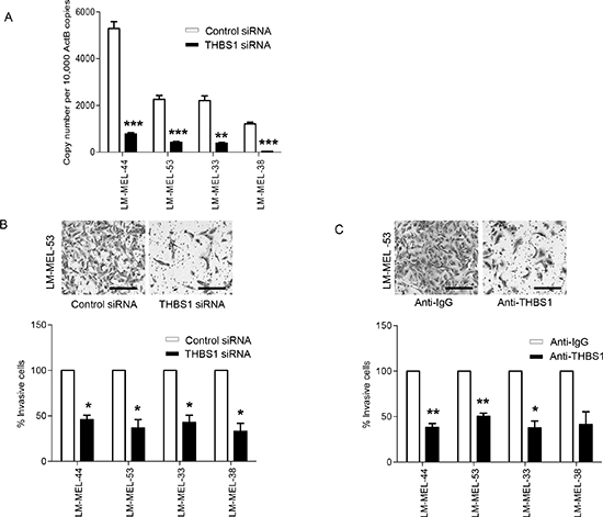 Targeting THBS1 results in loss of invasive potential of melanoma cells in vitro.