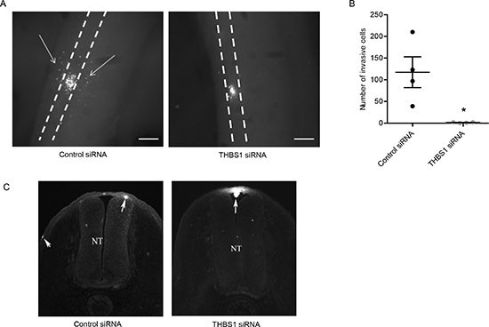 RNAi mediated loss of THBS1 blocks motility in in vivo chick model.