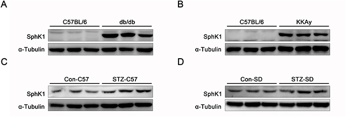 The expressions of SphK1 were upregulated in kidneys of diabetic animals.