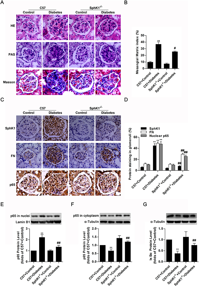 SphK1-/- diabetic mice exhibited less renal fibrotic lesions, FN accumulation and NF-&#x03BA;B nuclear accumulation in glomeruli of kidneys.