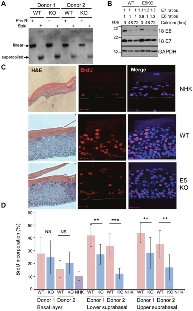 HPV18 E5 contributes towards unscheduled host cell DNA synthesis upon keratinocyte differentiation.