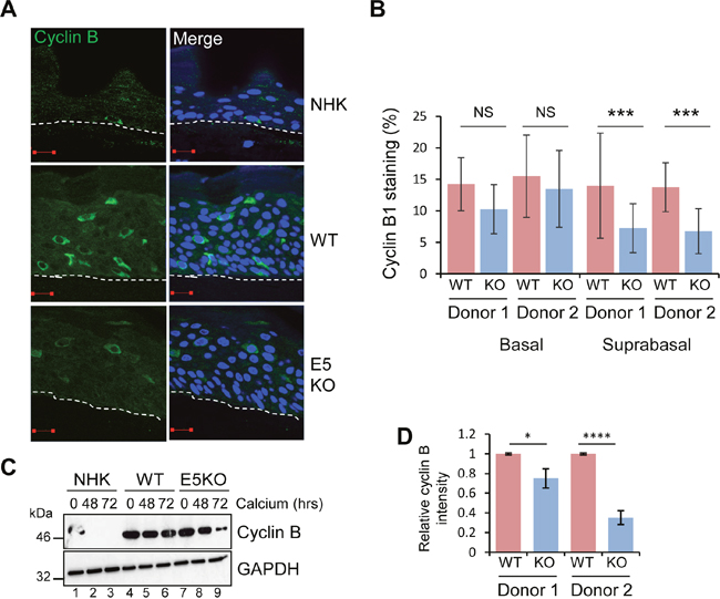 HPV18 E5 deregulates cell cycle progression in differentiated cells.