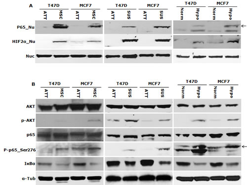 NF&#x3ba;B is responsible for maintaining CSC characters in suspension- and hypoxia-cultured cells.