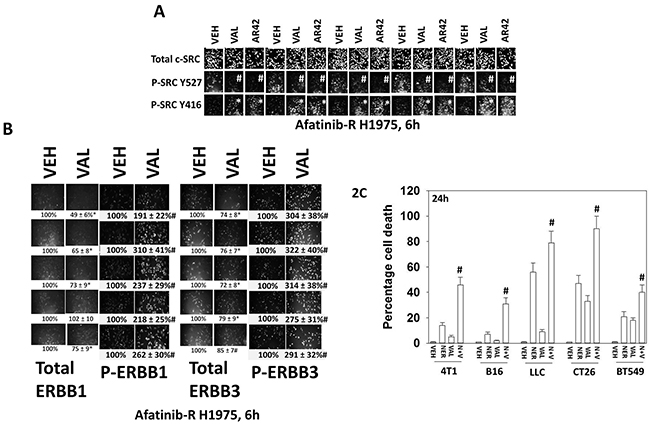 Valproate activates c-SRC/ERBB1/ERBB3 and its anti-tumor activity is enhanced by the ERBB1/2/4 suicide inhibitor neratinib.