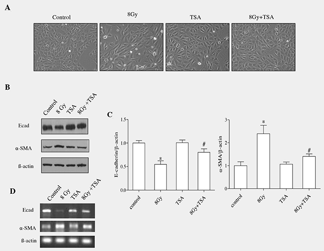 TSA inhibits EMT induced by irradiation in RLE-6TN cells.