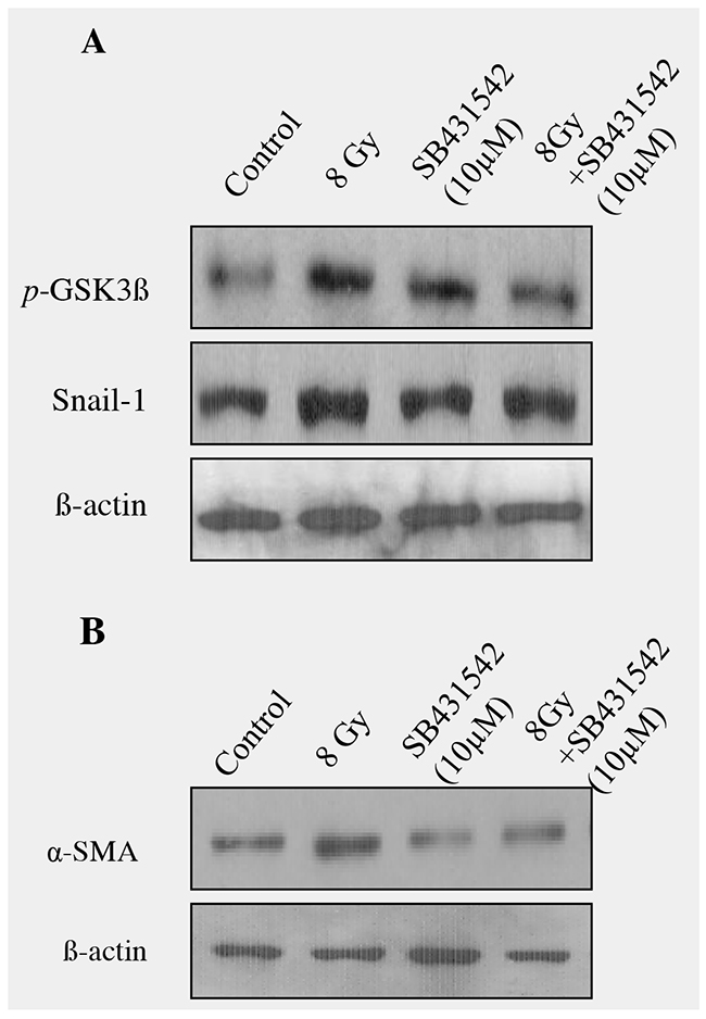 Blocking of TGF-&#x03B2; signaling with SB-431542 decreased radiation -induced EMT in RLE-6TNcells.