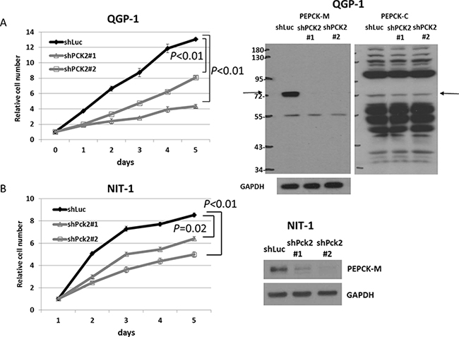 Cell proliferation curves of QGP-1 and NIT-1 cells with shRNA against PCK2 and Pck2 and vector control Luc from day 1 to day 5.