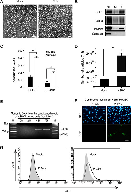 Isolation of extracellular vesicles (EVs) from KSHV-infected primary human endothelial cells.