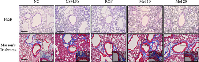 Melatonin attenuates inflammatory responses and collagen deposition in lung tissue induced by cigarette smoke and LPS exposure.