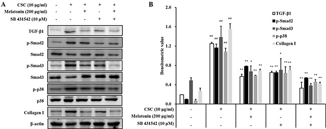 Melatonin down-regulates TGF-&#x03B2;1 in in H292 cells stimulated with cigarette smoke condensate (CSC).