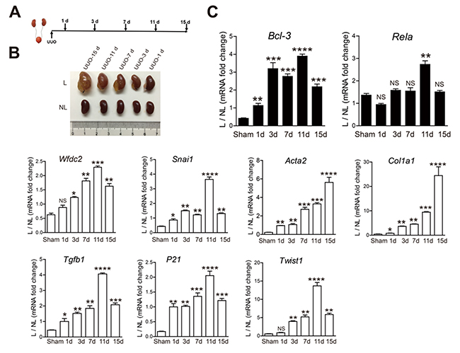 The Bcl-3 mRNA level persistently increased from 1 day after UUO.