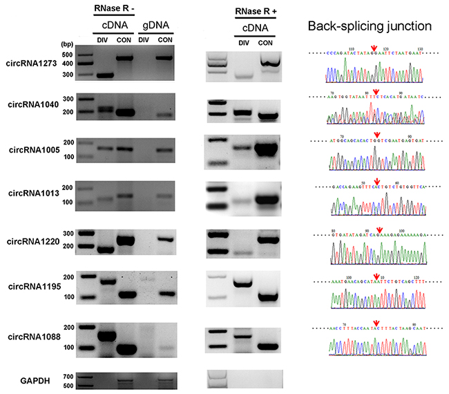 Verification of circRNAs using RT-PCR and Sanger sequencing.