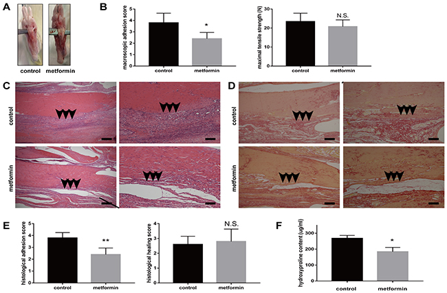 Metformin treatment reduces peritendinous tissue adhesion in tendon-injured rats.