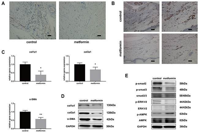 Metformin inhibits cell proliferation and TGF-&#x03B2;1 signaling pathway in vivo.