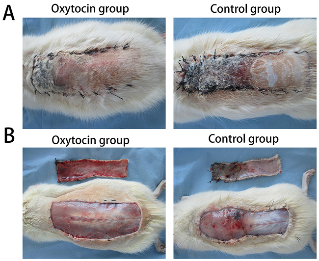 Skin flap survival and edema on postoperative day 7.