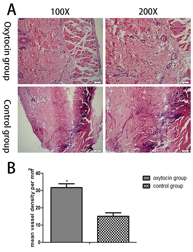 Histopathological changes in the skin flaps of the two groups.