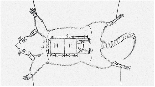 The flap(3cm&#x00D7;9cm) area was divided into three equal sized zones and marked as proximal(region I), intermediate (region II) and distal (region III).