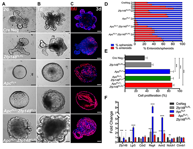 Deletion of Zfp148 induces cell differentiation in Cdx2:ApcFL/&#x002B; organoids.