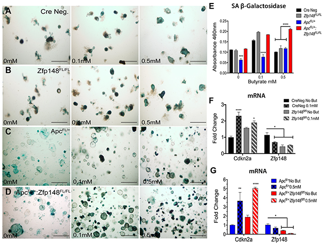 Loss of Zfp148 in the presence of butyrate initiates cellular senescence in ApcFL/&#x002B; organoids.