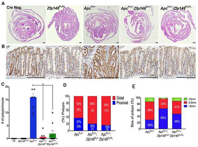 Deletion of Zfp148 reduces colonic polyps in Cdx2: ApcFL/&#x002B; mice.