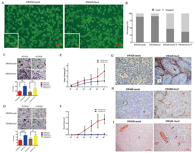 Overexpression of Sox2 promoted cell motility and tumorigenesis.