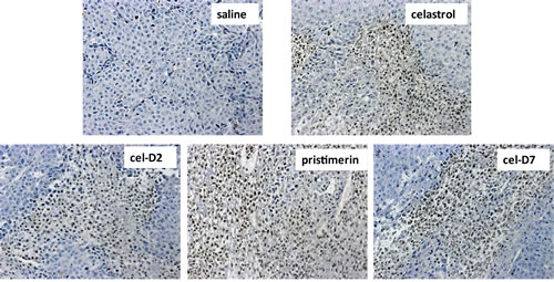 Fig. 5: Celastrol and its derivatives induced apoptosis (TUNEL Assay) in orthotopic HCC patient-derived xenografts.